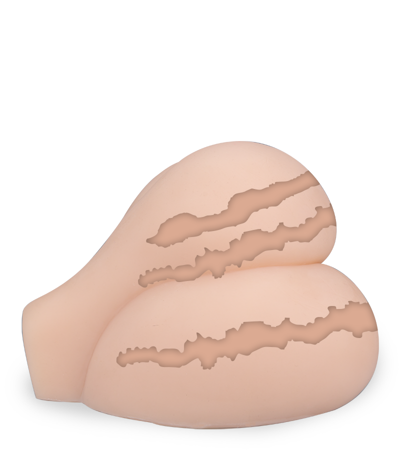 Doppel-Po mit Vagina und Anus